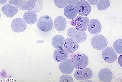microscope palu