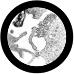 virus dengue